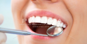 عکس و تصویر با کیفیت بالا و زیبای دندان و طرح لبخند و دندانپزشکی