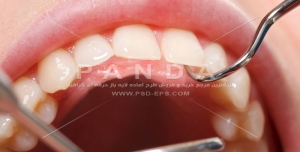 عکس و تصویر با کیفیت بالا و زیبای دندان و طرح لبخند و دندانپزشکی