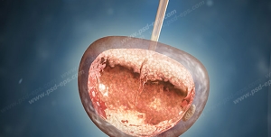 عکس با کیفیت عمل لقاح مصنوعی IVF در آزمایشگاه جهت درمان ناباروری و نازایی