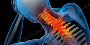 آناتومی اسکلت بدن انسان و درد و دیسک در قسمت مهره های گردن