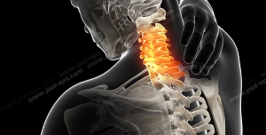 عکس با کیفیت آناتومی ستون فقرات و درد و آرتروز در قسمت مهره های گردن