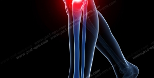 عکس با کیفیت آناتومی اسکلت پا و درد و آرتروز در قسمت مفصل زانو