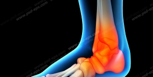 عکس با کیفیت آناتومی اسکلت پا از نمای نزدیک و درد و آرتروز در قسمت پاشنه و مچ پا