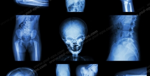 عکس با کیفیت آزمایش MRI و پرتونگاری از قسمت ها و اعضای بدن کودک ( سر ، دست ، پا ، شکم ، لگن ، گردن ، زانو و آرنج )