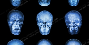عکس با کیفیت آزمایش MRI و تصویر برداری از مجموعه ای از جمجمه های سر